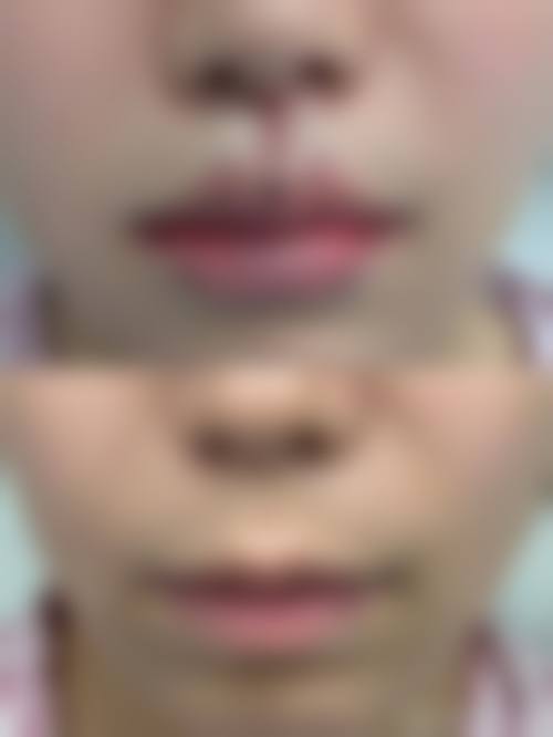 广州有鹿整形医院交通路线及预约