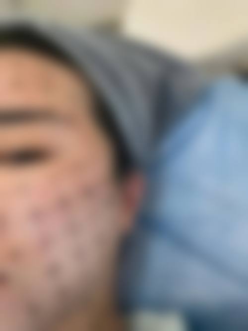 2026 杭州广仁整形美容医院价格参考