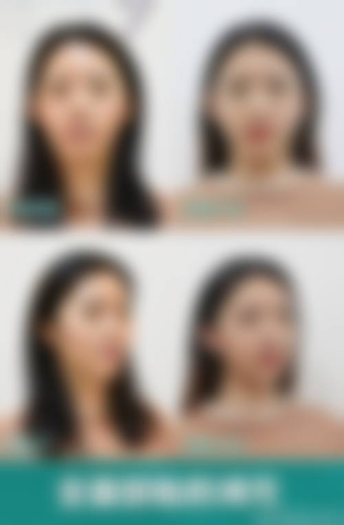 长沙雨花鳞颐整形医院核心项目