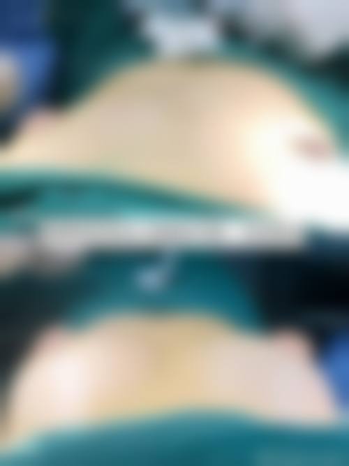 长沙赫美医疗美容门诊部核心项目