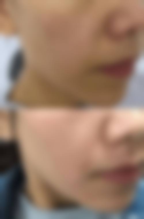 2026 连云港第一人民医院烧伤整形科价格参考