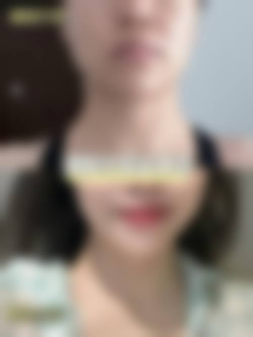 2026 长春长青丽人医疗整形医院价格参考