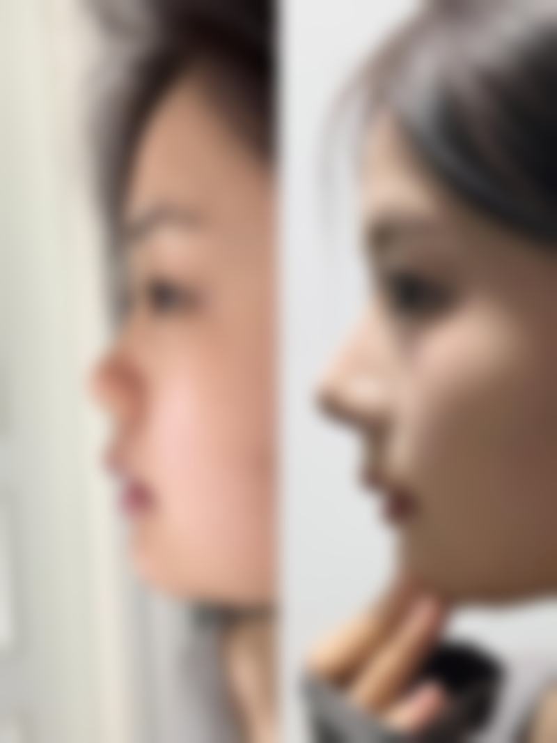 宁波高新区嘉莱美整形医院地址及到院路线