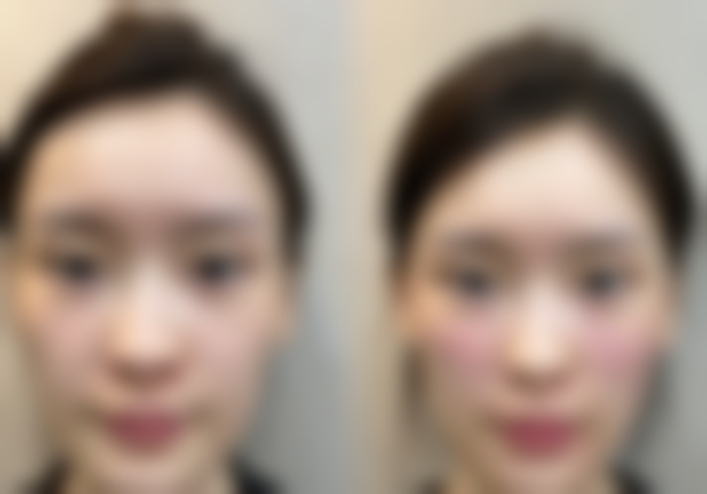 2026长沙雨花鳞颐整形医院价格参考