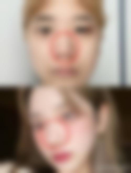 洛阳乐颜整形医院核心项目