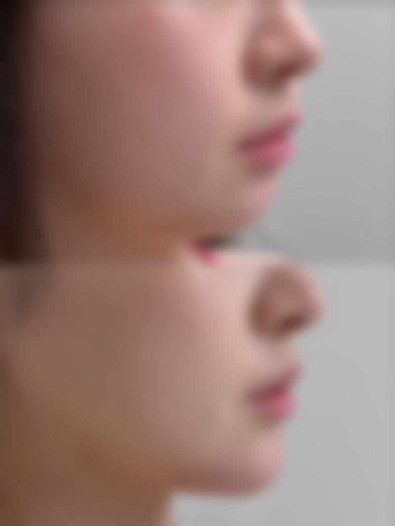 吴颖洁患者评价