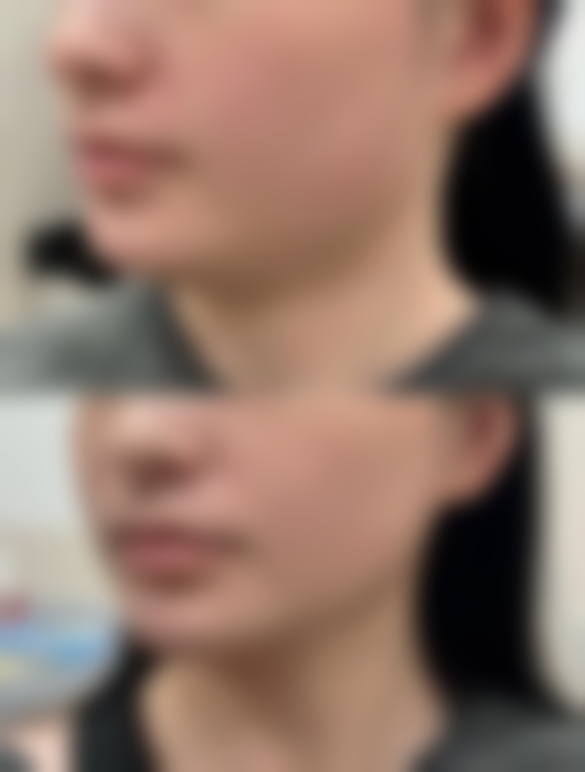 巴彦淖尔优嘉整形医院患者评价