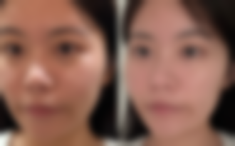 巴彦淖尔优嘉整形医院核心项目