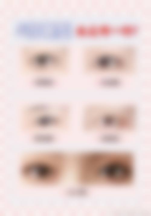 上海骏美整形医院患者评价