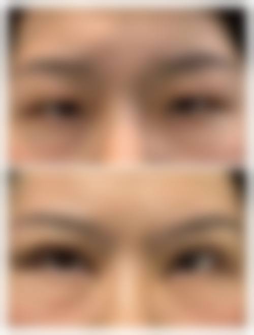 成都熙美雅娴整形医院患者评价