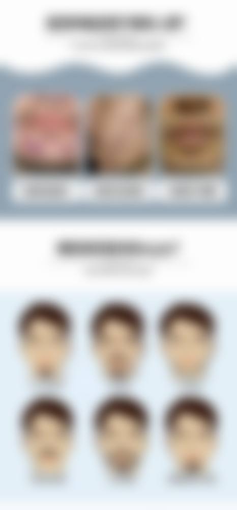 重庆碧莲盛植发患者评价