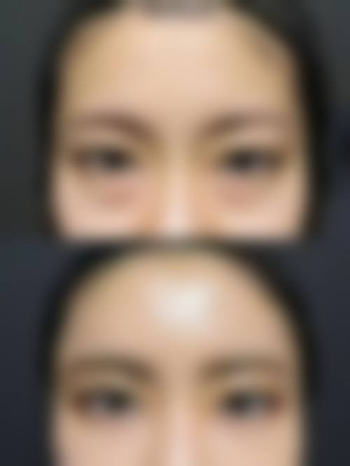 大连煜尔美微整形医院患者评价