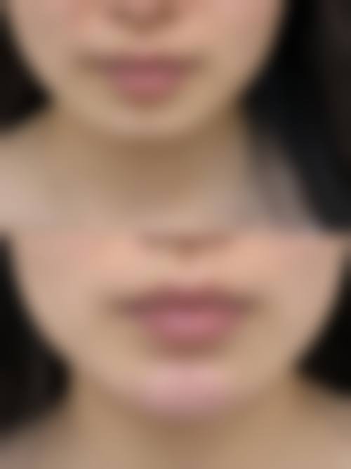 乌兰察布广秀医疗美容诊所核心项目