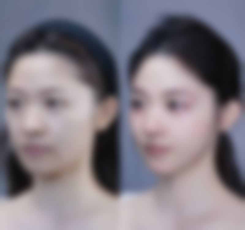 广州雪然医美(环贸店)核心项目