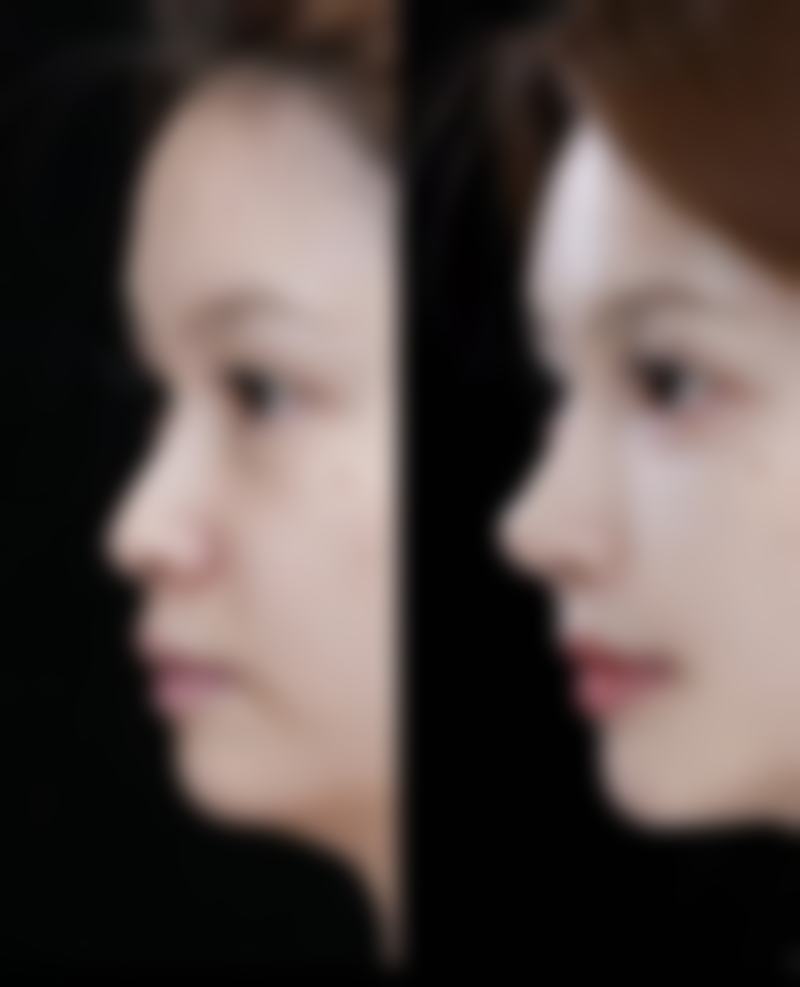 朱红预约方式及价格表