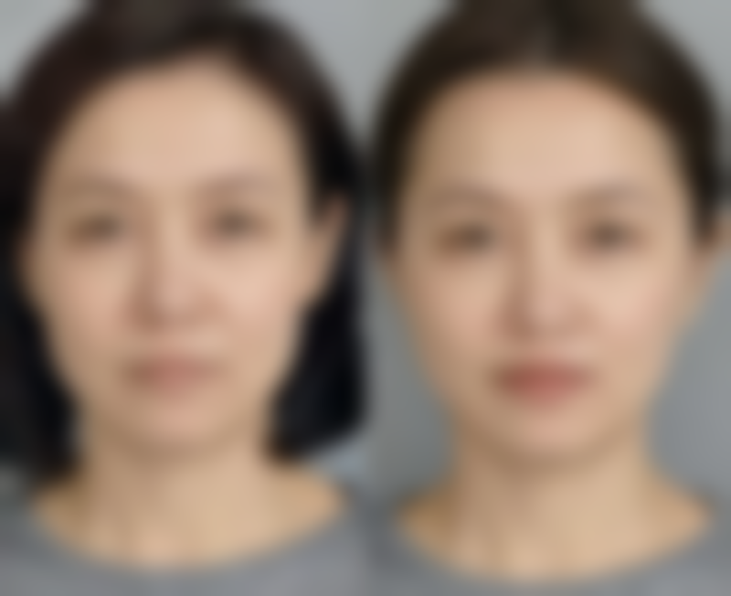 齐强擅长项目列表