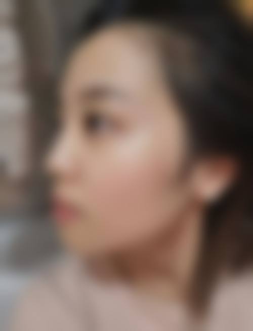 2026 韩国TN皮肤科价格参考