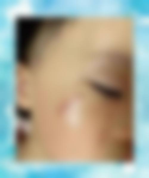 2026宁波华 山整形外科医院价格参考