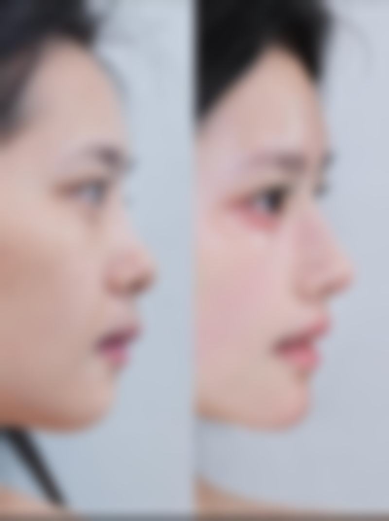 广州涵茜尚美医疗美容门诊部擅长项目有哪些？