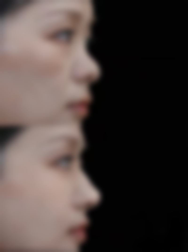 芜湖壹加壹整形医疗美容医院真实患者评价