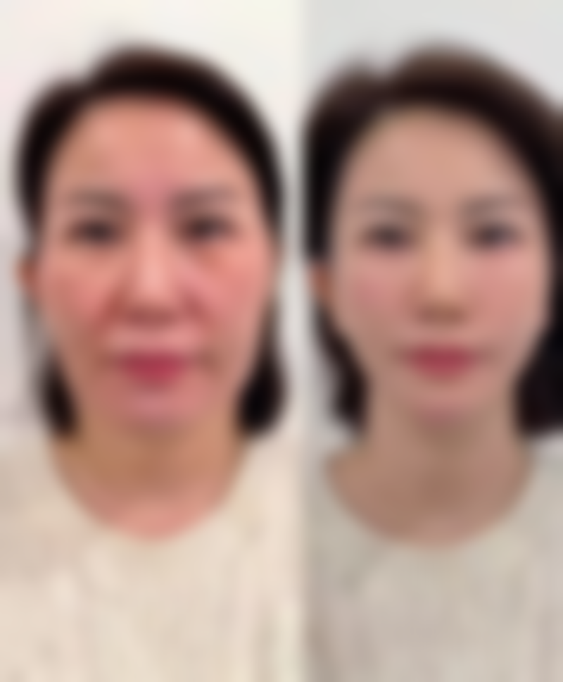 西安华医天美医疗科技美容真实患者评价