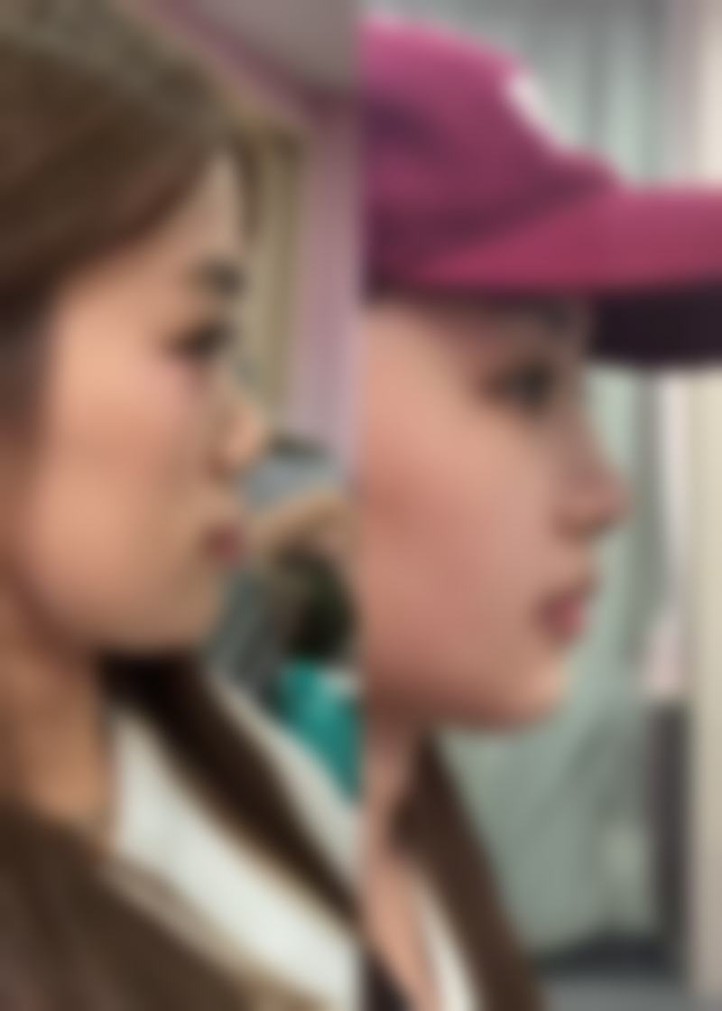 广州涵茜尚美医疗美容门诊部真实患者评价