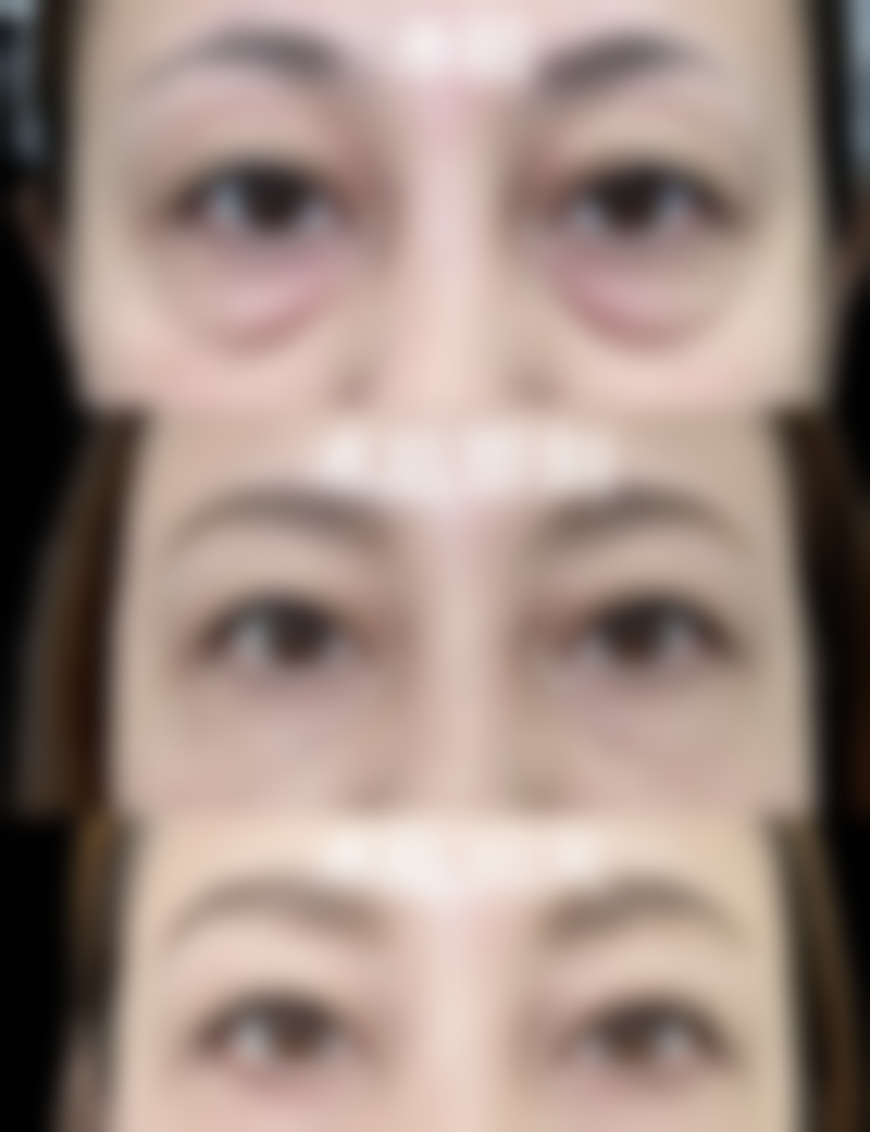 龙岩氧颜蔻天彦整形医院真实患者评价