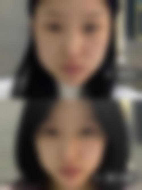 遂宁双华医疗美容整形真实患者评价