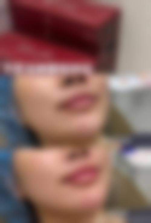 营口更美医疗美容诊所真实患者评价