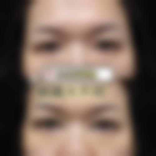 2026 长沙赵玉医疗美容诊所项目价格参考