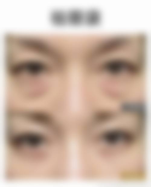 青岛瑞美医疗美容诊所交通路线及预约方式