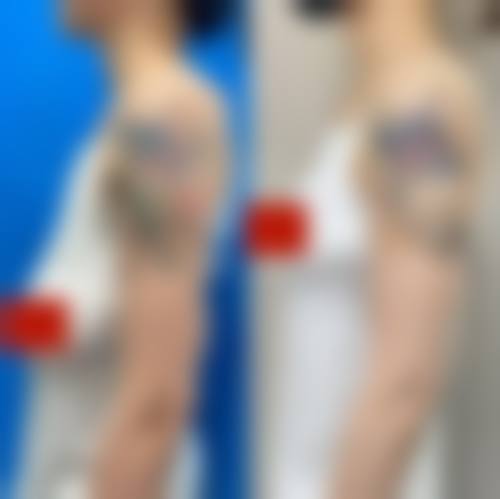 重庆真伊整形美容医院项目价格参考