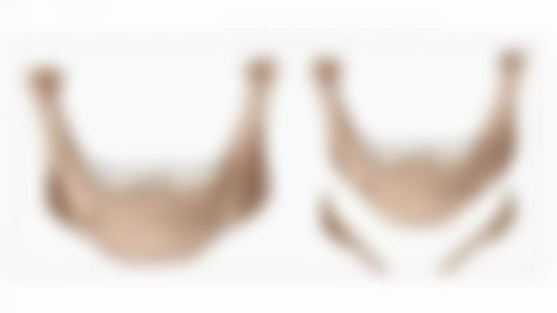 韩国眼鼻美人整形外科医院