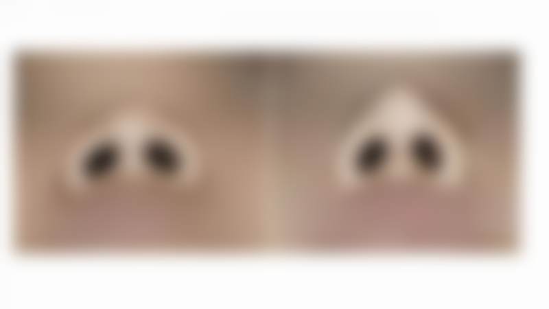 2026 韩国眼鼻美人整形外科医院项目价格参考