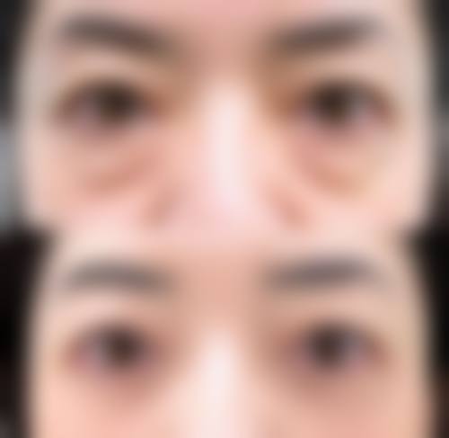 临沧云肤整形医院真实患者评价