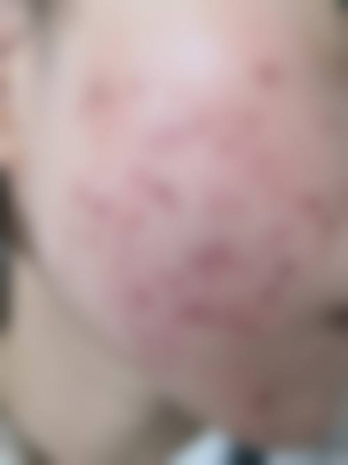 蚌埠立方医疗美容诊所擅长项目有哪些？