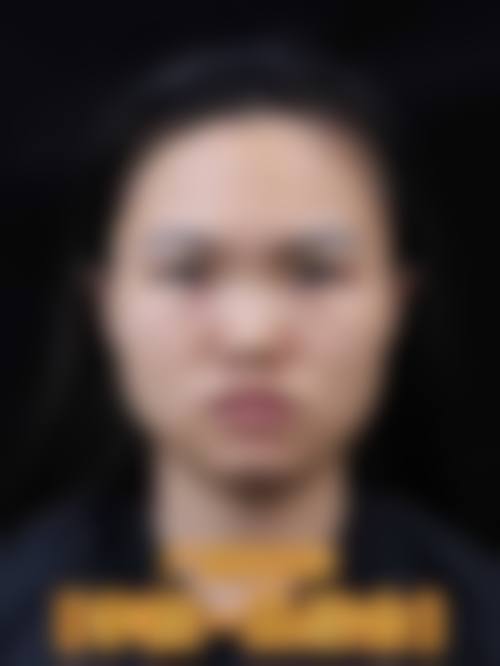 镇江西婵医疗美容门诊真实患者评价