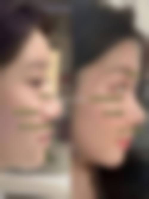 大连海光医疗美容诊所真实患者评价