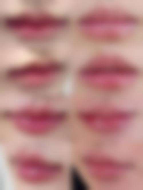 2026 太原麦西医疗美容门诊部项目价格参考