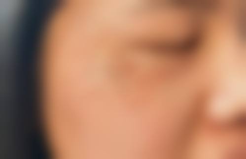 太原麦西医疗美容门诊部擅长项目有哪些？