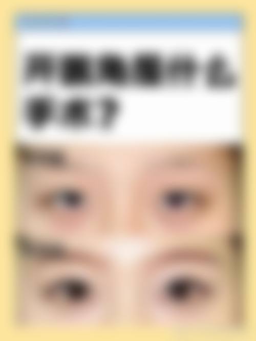 浙江省杭州市第一人民医院医学美容整形科擅长项目有哪些？