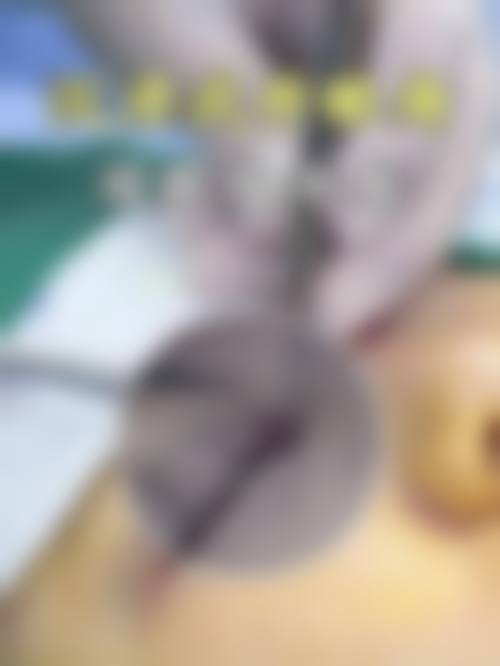 日本池本形成外科·美容外科医院真实患者评价