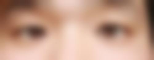 日本池本形成外科·美容外科医院擅长项目有哪些？