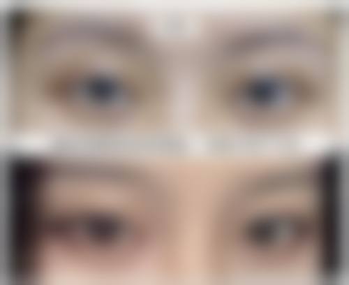 鸡西梁术仙美容整形专科医院真实患者评价