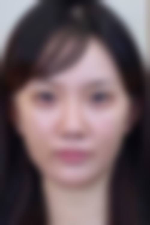 兴义刺刻唐医美整形中 心真实患者评价