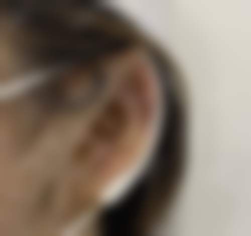 北京西美斯医疗美容诊所真实患者评价