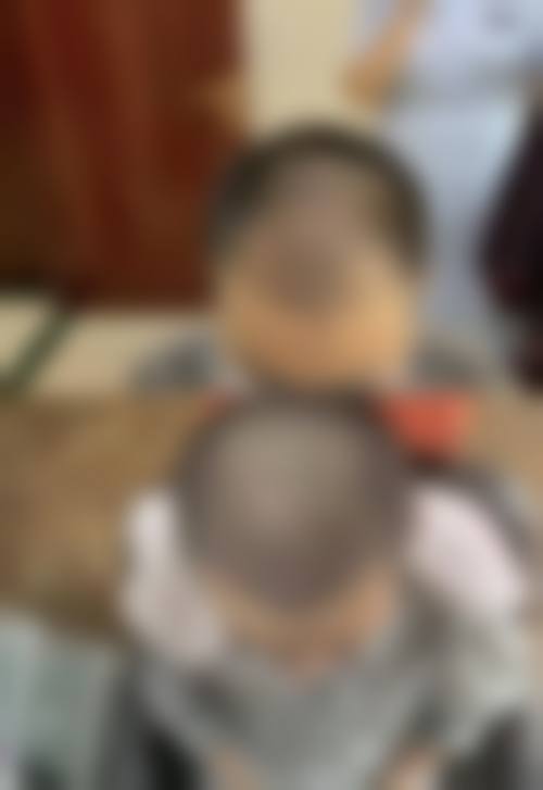 2026苏州新生植发项目价格参考