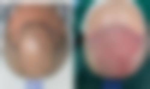 北京丽扬医疗美容诊所真实患者评价