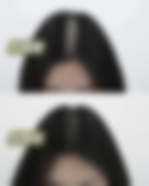 苏州新生植发擅长项目有哪些？