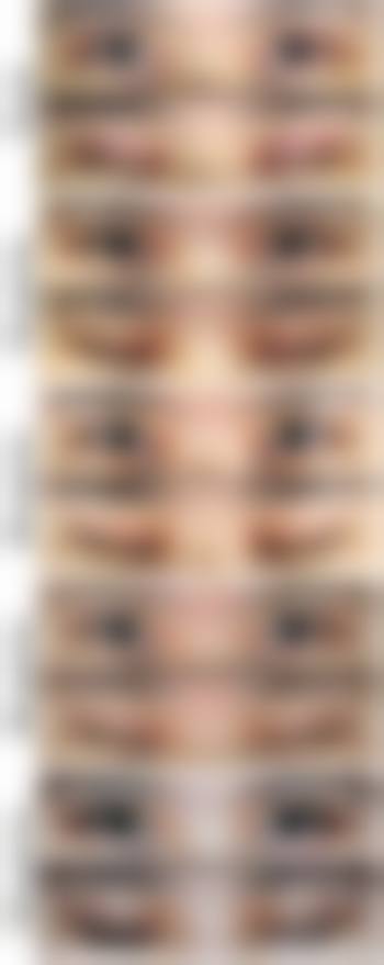 孝感欧阳整形美容诊所真实患者评价